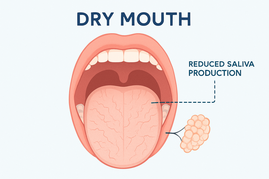 The Hidden Damage of Dry Mouth: How Xerostomia Wears Down Your Oral Environment